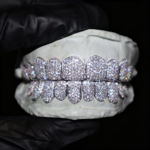 Puede incluir: Grillz plateados, incrustados con numerosas piedras preciosas pequeñas y brillantes, se exhiben sobre un molde dental blanco. Los grillz son hechos a medida, destacando el diseño detallado. El fondo es negro.