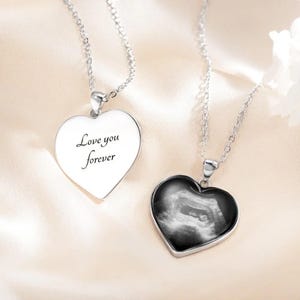 Custom Baby Sonogram Necklace Heart Shape, Ultrasound Photo Jewelry with Engraving, Pregnancy Gift, Newborn Keepsake for Mom, Miscarriage