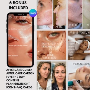 Microneedling Instagram Template: Esthetician Social Media Kit (Digital Download)