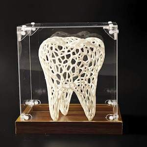 Puede incluir: Un modelo de diente blanco en tres dimensiones con estructura de celosía, encerrado en una caja de acrílico transparente con una base de madera marrón oscuro. El diseño intrincado y reticulado forma la silueta de una muela en el marco.