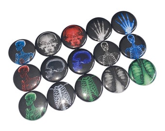 Radiology, Xray, 1", 1.25", Button, Xray Theme, Ribs, Spine, Lungs, Skull, Hand Bone, Radiology Theme, Bone, Flatback, Pinback, Badge, XR008