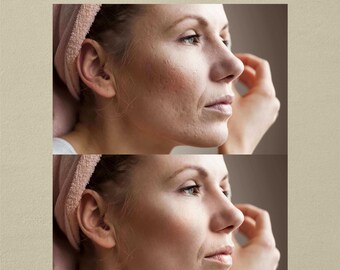 Professional Portrait Photo Retouching (Fix Blemishes, Whiten Teeth / Eyes, Adjust Color / Exposure, Change Background, Smooth Wrinkles etc)
