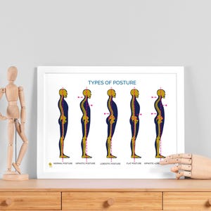 Op de afbeelding: Een ingelijste print getiteld "TYPES OF POSTURE" toont illustraties van menselijke profielen, die elk een ander type houding weergeven. De figuren zijn geel en paars, met labels eronder. De print staat op een houten oppervlak.