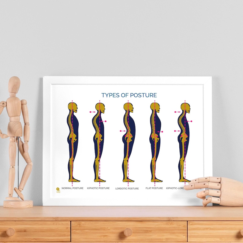 Op de afbeelding: Een ingelijste print getiteld "TYPES OF POSTURE" toont illustraties van menselijke profielen, die elk een ander type houding weergeven. De figuren zijn geel en paars, met labels eronder. De print staat op een houten oppervlak.