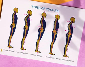 Types of Posture Anatomy Poster A2 Size Digital Download Postural Assessment Wall Chart Physiotherapy & Pilates Printable