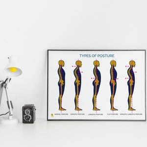 Op de afbeelding: Een ingelijste poster met de titel "TYPES OF POSTURE" toont vijf illustraties van menselijke profielen, die elk een ander type houding weergeven: normaal, kyfotisch, lordotisch, plat en kyfotisch-lordotisch. De figuren zijn blauw en goud, met rode lijnen die de houdingsuitlijning aangeven.