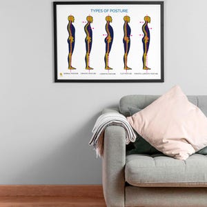 Op de afbeelding: Een ingelijste poster met de titel "TYPES OF POSTURE" toont vijf anatomische illustraties van de menselijke wervelkolom in profiel. Elke figuur is gekleurd met geel, paars en oranje, die verschillende houdingen weergeven. De poster staat in een zwart frame.