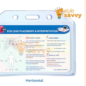 ECG Reference Card: Lead Placement & Interpretation (printable PDF ...