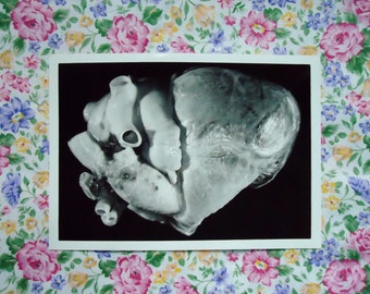 5 Vintage human heart anatomy photographs 5"x7"