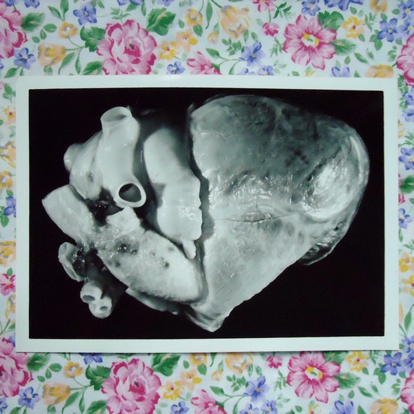 5 Vintage human heart anatomy photographs 5"x7"