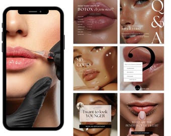 Lip Filler Instagram Templates, Nurse Injector Social Media, Lip Filler Posts, Lip Filler Marketing, Botox & Filler Social Media Templates