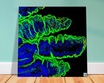 Aluminum Print - Parasite Life Cycle Glow Artwork with QR Code