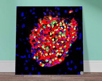 Aluminum Print - Pancreatic Islet Regeneration Artwork with QR Code