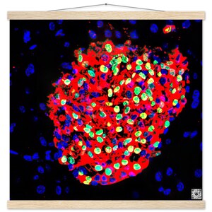 Poster in carta opaca premium con gancio - Opera d'arte sulla rigenerazione delle isole pancreatiche con link di ricerca QR