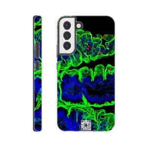 Puede incluir: Funda de teléfono inteligente negra con un diseño abstracto vibrante en colores neón verde, azul y rojo. La funda tiene un acabado brillante y un código QR en la parte inferior. El lateral de la funda también está decorado con un patrón similar.