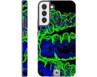 Tough case for Samsung - Parasite Life Cycle Glow Artwork with QR Code