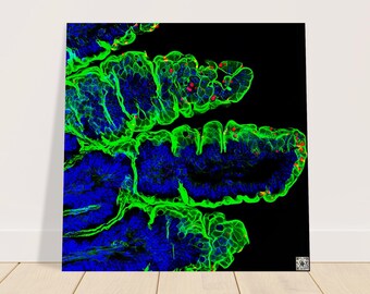 Wood Print - Parasite Life Cycle Glow Artwork with QR Code