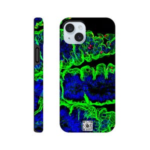 May include: A smartphone case with a striking abstract pattern in green, blue, and red on a black backdrop. The case has a glossy finish and a camera aperture. The side of the case is black.