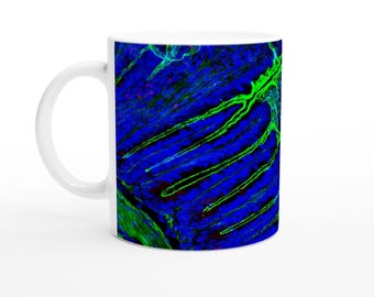 11oz Ceramic Mug - Parasite Life Cycle Glow Artwork with QR Code