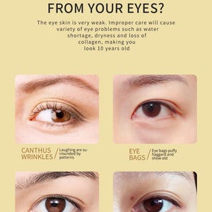 May include: Close-up image of four different eye areas showing common eye problems. The image shows wrinkles around the eyes, eye bags, dark circles under the eyes, and fatty deposits around the eyes. The text in the image reads: "Many factors cause eye problems to come to your door. Do you feel annoyance from your eyes? The eye skin is very weak. Improper care will cause variety of eye problems such as water shortage, dryness and loss of collagen, making you look 10 years old. Canthus wrinkles/Laughing are surrounded by patterns. Eye bags/Eye bags puffy haggard and show old. Panda eyes/Too many foundation can not cover up. Fatty grains/Excess nutrition erodes your eyemuscle."
