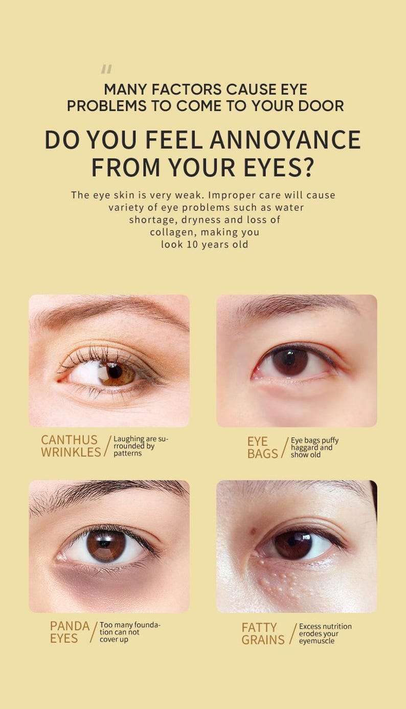 May include: Close-up image of four different eye areas showing common eye problems. The image shows wrinkles around the eyes, eye bags, dark circles under the eyes, and fatty deposits around the eyes. The text in the image reads: "Many factors cause eye problems to come to your door. Do you feel annoyance from your eyes? The eye skin is very weak. Improper care will cause variety of eye problems such as water shortage, dryness and loss of collagen, making you look 10 years old. Canthus wrinkles/Laughing are surrounded by patterns. Eye bags/Eye bags puffy haggard and show old. Panda eyes/Too many foundation can not cover up. Fatty grains/Excess nutrition erodes your eyemuscle."