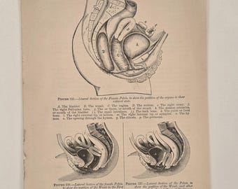 アンティーク骨盤リトグラフ、女性の解剖学、1905年の医学図解（9.5x7