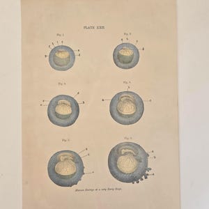 May include: Antique print titled "PLATE XXII" featuring six detailed illustrations of a human embryo at a very early stage. The diagrams are in blue, yellow, and brown, with labels. The print is on aged paper.