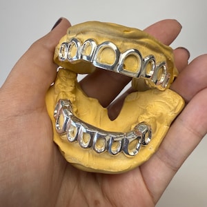 Custom Gold Grillz: Open Face Design, High-Gloss Polish