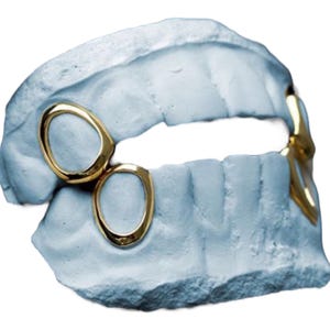 May include: A light blue dental mould featuring gold teeth grills. The gold grills are oval-shaped and are placed on the front teeth. The mould shows the shape of the teeth.
