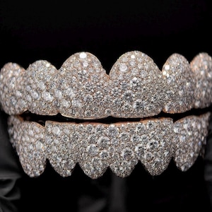 Könnte beinhalten: Ein Satz maßgefertigter, mit Diamanten besetzter Zahn-Grillz. Die Grillz bestehen aus goldfarbenem Metall und sind vollständig mit kleinen, funkelnden Diamanten bedeckt. Die oberen und unteren Sets werden vor schwarzem Hintergrund gezeigt.