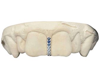 Puede incluir: Una rejilla de oro con una fila vertical de piedras preciosas azules y transparentes. La rejilla está colocada en un molde de boca.