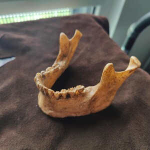 May include: A tan-colored human jawbone with visible teeth. The jawbone is resting on a dark brown, textured surface. The bone has a weathered appearance, suggesting age or a natural process.