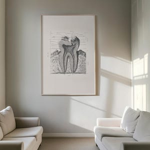 Large framed vintage tooth cross-section diagram displayed between two white sofas in a bright room, medical-themed wall art.