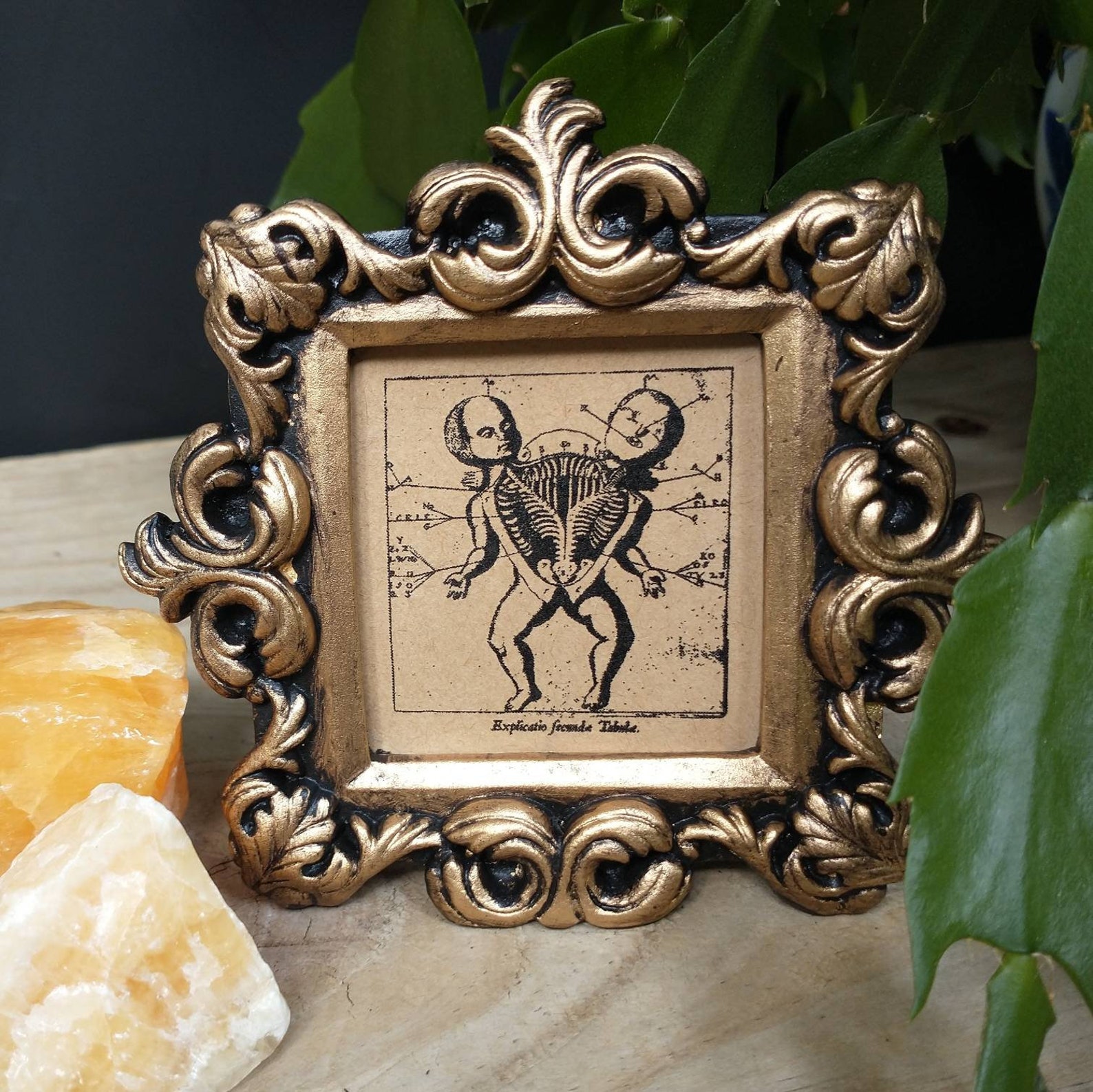 Conjoined Twins Anatomy Print in Baroque Frame Vintage Etsy