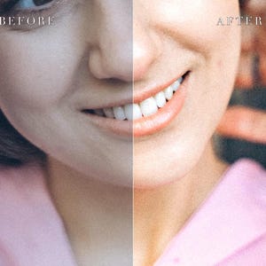 Lightroom Presets Bundle, Clean Girl 6 Preset Pack, Mobile & Desktop Photo Filter, Instagram Aesthetic, Instant Download