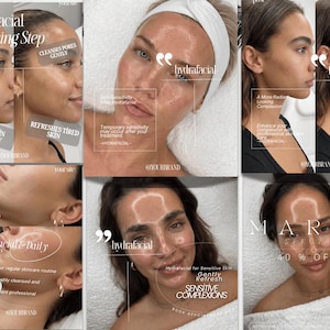 May include: A collage of six images showcasing skincare treatments with text overlays including Hydrafacial Cleansing Step, Removes Dirt Buildup, Cleanses Pores Gently, Prepares Skin Thoroughly, Refreshes Tired Skin, Skin Sensitivity, A More Radiant Looking Complexion, March Special 40% Off.