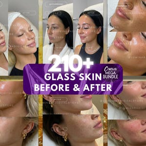 May include: A collage of before and after images showcasing skincare results. The images feature close-up shots of faces, highlighting changes in skin texture and appearance. Text overlay reads "210+ Glass Skin Bundle Before & After".