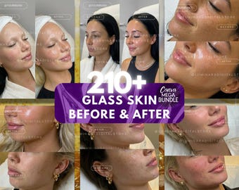 Glass Skin Inspired Instagram Template | Med Spa Social Media Post | Editable Canva Template for Estheticians | Digital Download