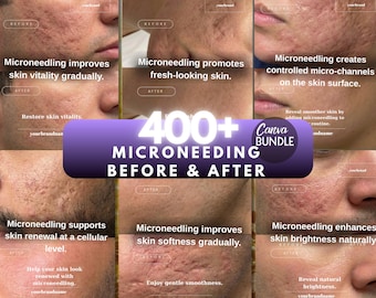 Microneedling Vorher & Nachher Canva Vorlage, Haut Transformation Instagram Post, Ästhetische Klinik Bearbeitbar Digitaler Download