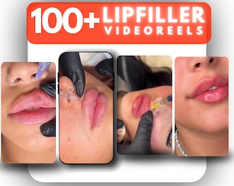 Lip Filler Before & After Video: Medspa Instagram Reel (Editable MP4 Format