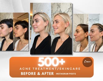 Skincare Instagram, Skincare before &after, Medspa Templates, Dermatology Templates, Skincare Stories Skincare Instagram