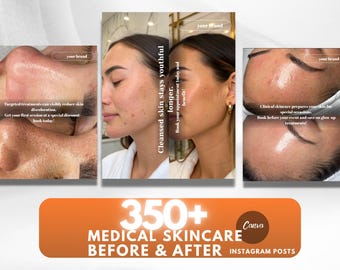 Modelos de mídia social para esteticistas: designs de cuidados com a pele antes e depois do Canva (download digital)