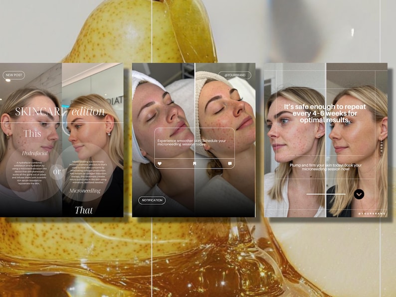 K&ouml;nnte beinhalten: Werbung f&uuml;r Hautpflege mit dem Gesicht einer Frau und Text&uuml;berlagerungen. Der Text lautet "SKINCARE edition", "This or That" und "It's safe enough to repeat every 4-6 weeks for optimal results."