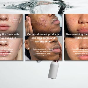 May include: A skincare product advertisement featuring close-up images of faces with acne. Text highlights factors that can affect skin, including menstrual cycles and over-washing. A white bottle is also visible.