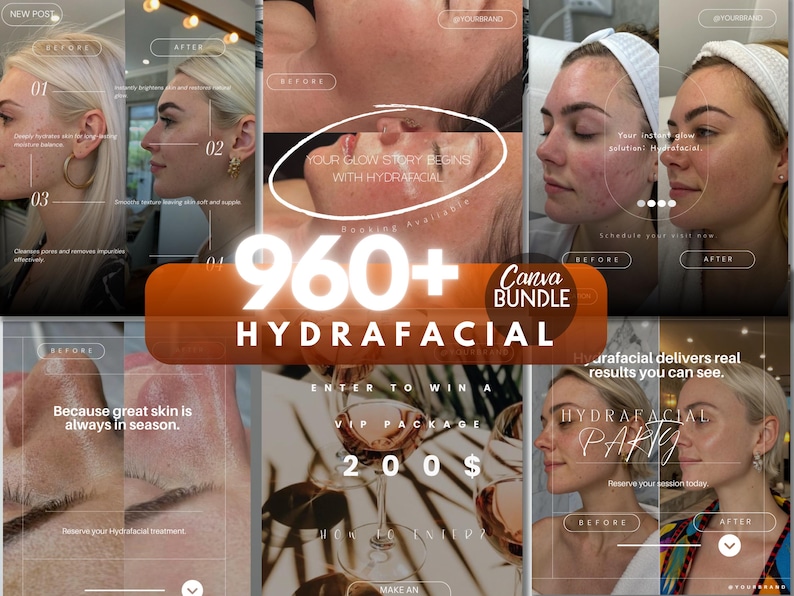 May include: A collage of images promoting HydraFacial treatments. The images show before and after results, with text overlays including "960+ Canva Bundle" and "Your glow story begins with HydraFacial."