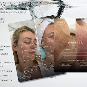 May include: Image showcasing a promotional graphic for a facial treatment service. The graphic includes before and after photos, text about Instagram posts, stories, and video reels, and information about customizable templates, text editing, color and font changes, and photo adjustments.