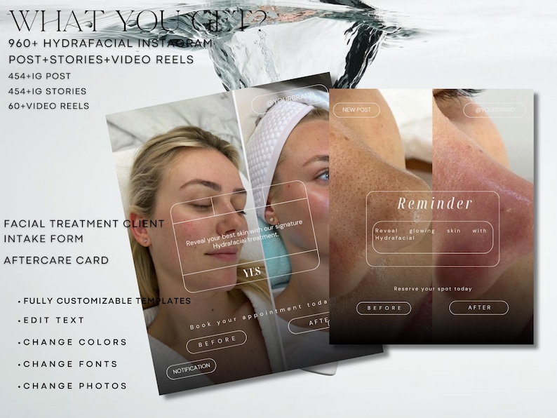 May include: Image showcasing a promotional graphic for a facial treatment service. The graphic includes before and after photos, text about Instagram posts, stories, and video reels, and information about customizable templates, text editing, color and font changes, and photo adjustments.