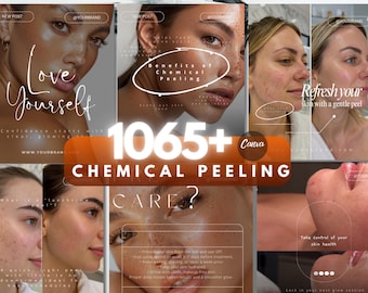 Może przedstawiać: Kolaż promujący zabiegi peelingu chemicznego. Centralny obraz zawiera tekst "1065+ CHEMICAL PEELING". Inne obrazy przedstawiają twarze i tekst, w tym "Love Yourself" i "Refresh your skin with a gentle peel".