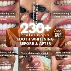 Könnte beinhalten: Eine Collage mit Vorher-Nachher-Bildern von Zahnaufhellungsbehandlungen. Die Bilder zeigen verschiedene Lächeln mit Texten, die die Vorteile hervorheben, wie z. B. Aufhellung der Zähne und Entfernung von Flecken. Der zentrale Text lautet "230+ Professionelles Zahnaufhellung Vorher & Nachher."