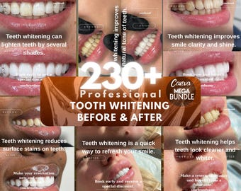 May include: A collage showcasing before and after images of teeth whitening treatments. The images display various smiles with text highlighting the benefits, such as lightening teeth and removing stains. The central graphic reads "230+ Professional Tooth Whitening Before & After."